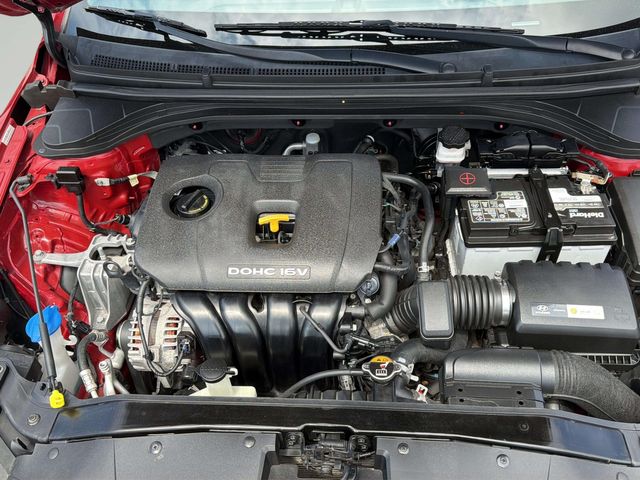 2017 Hyundai ELANTRA SE | Alpharetta, GA | Star Motors 2017 Hyundai ELANTRA SE | Alpharetta, GA | Star Motors
