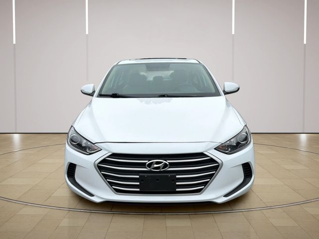 2017 Hyundai ELANTRA Limited | Alpharetta, GA | Star Motors 2017 Hyundai ELANTRA Limited | Alpharetta, GA | Star Motors