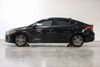 2018 Hyundai ELANTRA SEL | Plano, TX | Consign My Vehicle 2018 Hyundai ELANTRA SEL | Plano, TX | Consign My Vehicle