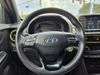 2018 Hyundai KONA Limited | San Antonio, TX | Texas Auto Save 2018 Hyundai KONA Limited | San Antonio, TX | Texas Auto Save