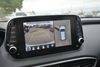 2019 Hyundai SANTA FE Ultimate 2.0T | Memphis, Tennessee | Memphis Car Smart 2019 Hyundai SANTA FE Ultimate 2.0T | Memphis, Tennessee | Memphis Car Smart