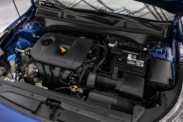 2020 Kia Forte LXS | Addison, TX | Addison Autoplex