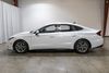 2021 Hyundai SONATA SEL | Plano, TX | Consign My Vehicle 2021 Hyundai SONATA SEL | Plano, TX | Consign My Vehicle